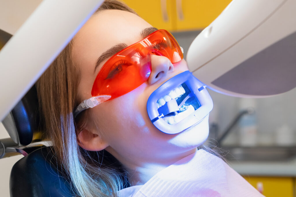 blanchiment dentiste dr dominguez benjamin marlenheim
