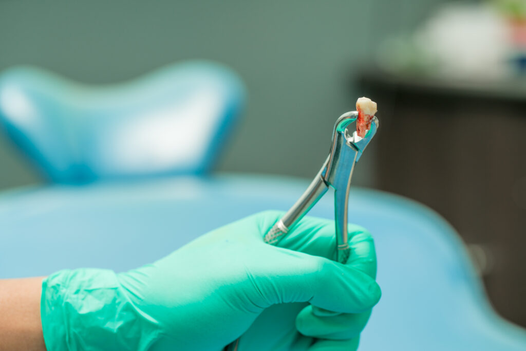 extraction dent dentiste Marlenheim Dr Dominguez Benjamin